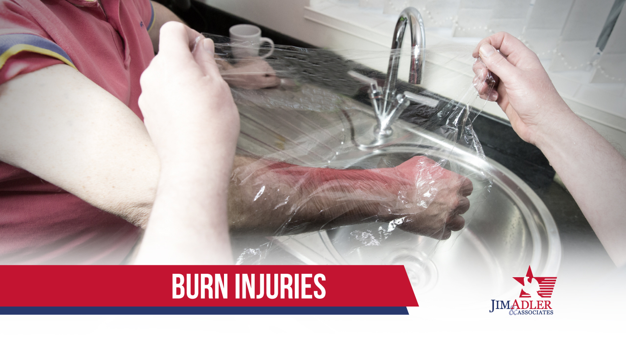 Burn Injuries